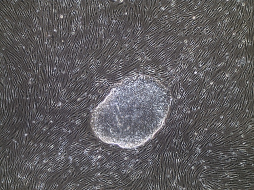Translational Pluripotent Stem Cell Program
